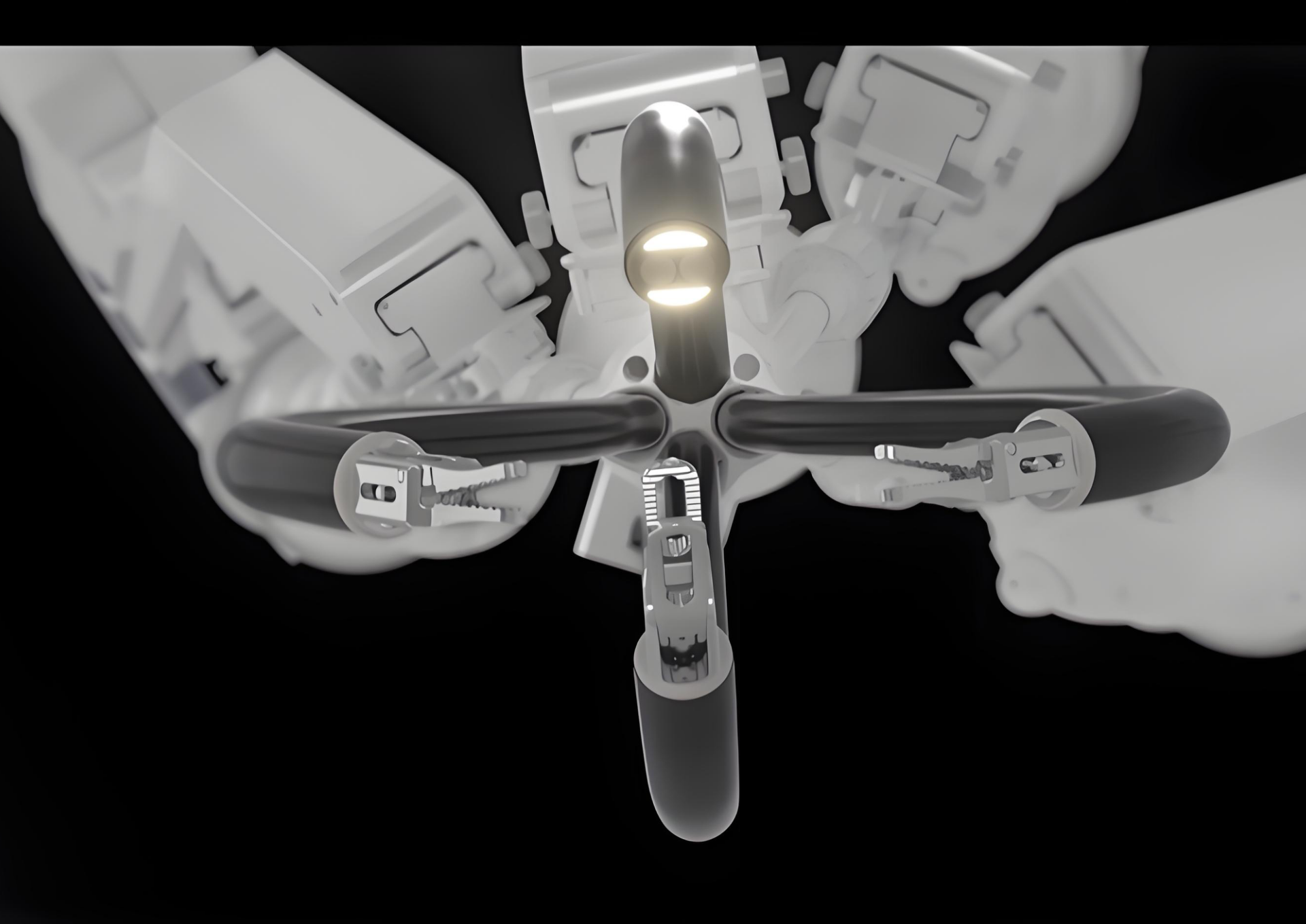 Patient-centered Single-Port Minimally Invasive Surgery