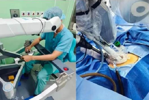 Shanghai's First SHURUI<sup>®</sup> Single-Port Robotic Segmentectomy Completed at Ruijin Hospital